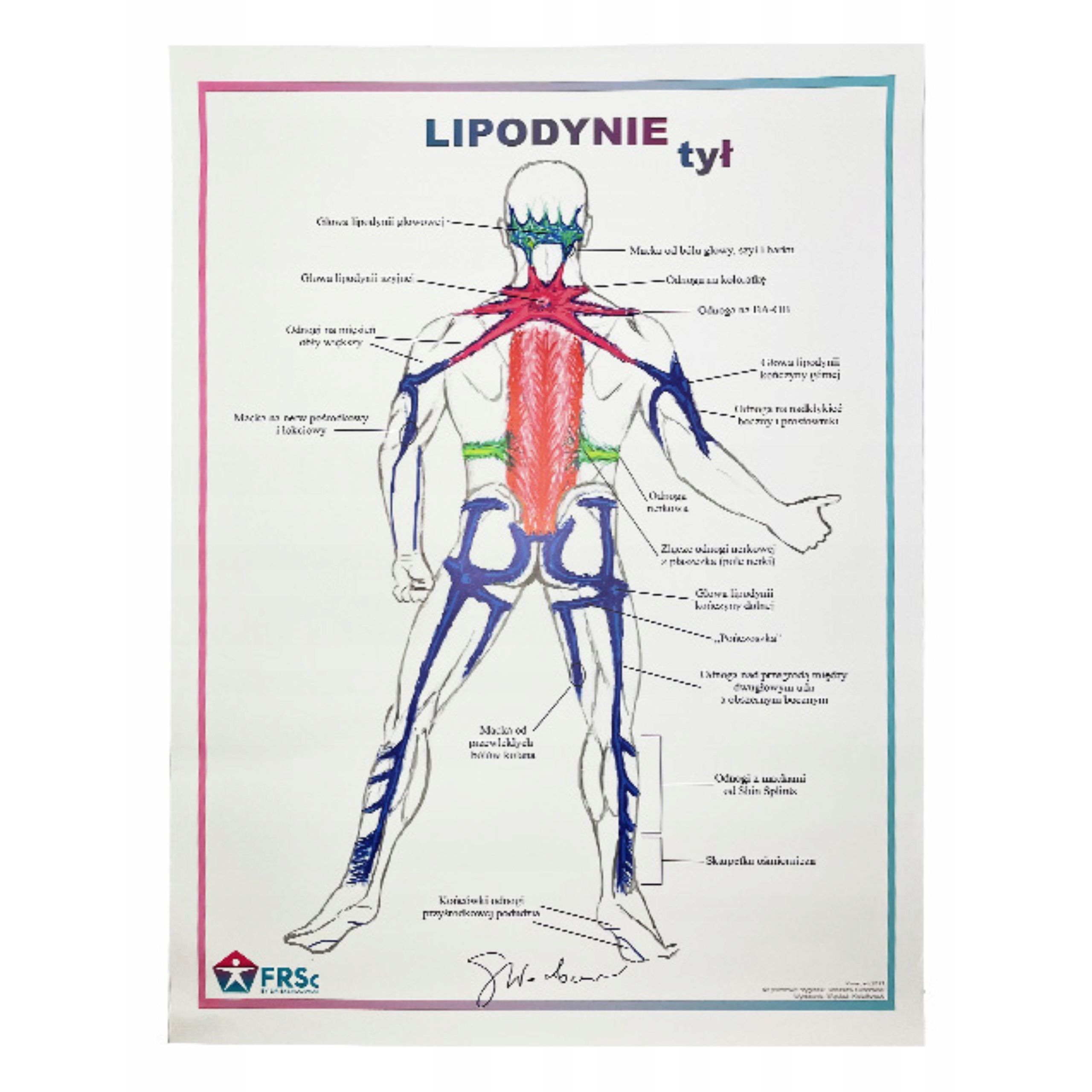  Anatomický plagát plagát lipodynie koniec