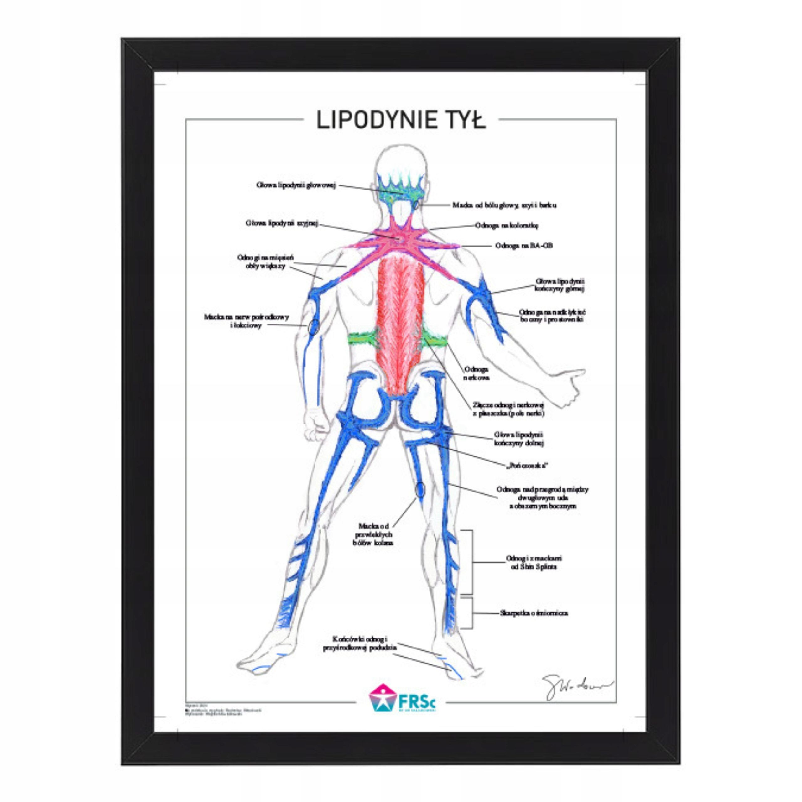  Plagát anatomické lipodynie koniec bezrámové 30x40 cm skladowski
