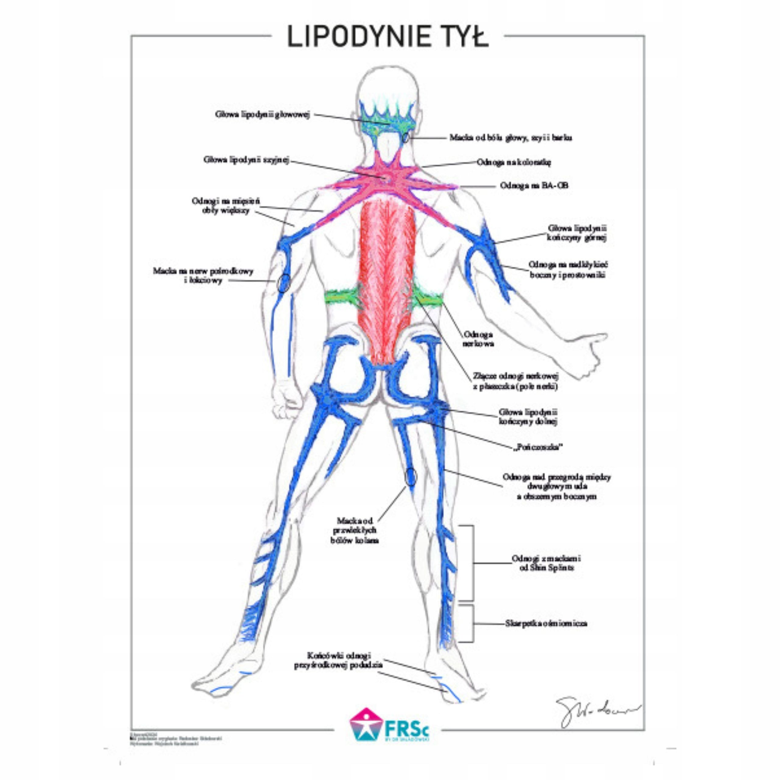  Plagát anatomické lipodynie koniec bezrámové 30x40 cm papier kriedový mat